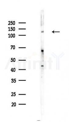 JAK2 Recombinant Rabbit mAb - Western blot analysis of lysates from HUVEC cells(LPS,4h treatment), using JAK2 Recombinant Rabbit mAb at 1/1000 dilution.