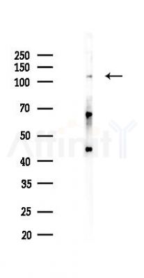 JAK2 Recombinant Rabbit mAb - Western blot analysis of lysates from HepG2 cells(starvation,24h treatment), using JAK2 Recombinant Rabbit mAb at 1/1000 dilution.