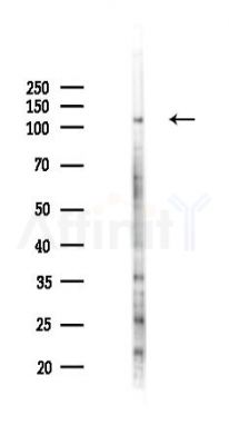 JAK2 Recombinant Rabbit mAb - Western blot analysis of lysates from Rat spleen, using JAK2 Recombinant Rabbit mAb at 1/1000 dilution.
