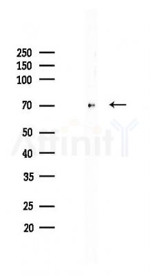 p70 S6 Kinase Recombinant Rabbit mAb - Western blot analysis of lysates from HUVEC cells(LPS,4h treatment), using S6K1 Recombinant Rabbit mAb at 1/1000 dilution.