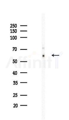 p70 S6 Kinase Recombinant Rabbit mAb - Western blot analysis of lysates from HepG2 cells(starvation,24h treatment), using S6K1 Recombinant Rabbit mAb at 1/1000 dilution.