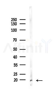 LC3B Recombinant Rabbit mAb - Western blot analysis of lysates from Rat lung, using LC3B Recombinant Rabbit mAb at 1/1000 dilution.