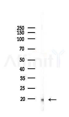 LC3B Recombinant Rabbit mAb - Western blot analysis of lysates from Hela cells(LPS, 4h treatment), using LC3B Recombinant Rabbit mAb at 1/1000 dilution.