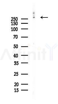 Fibronectin Recombinant Rabbit mAb - Western blot analysis of lysates from K562 cells(UV 30min treatment), using Fibronectin Recombinant Rabbit mAb at 1/1000 dilution.
