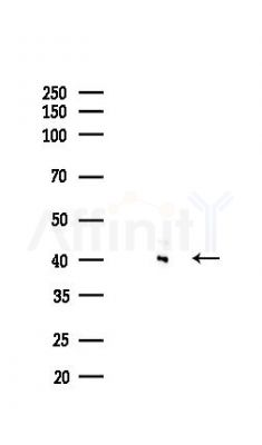 GSK3 beta Recombinant Rabbit mAb - Western blot analysis of lysates from HepG2 cells(starvation,24h treatment), using GSK3 beta Recombinant Rabbit mAb at 1/1000 dilution.