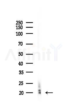 AIF1/IBA1 Recombinant Rabbit mAb - Western blot analysis of lysates from Rat lung, using Iba1 Recombinant Rabbit mAb at 1/1000 dilution.