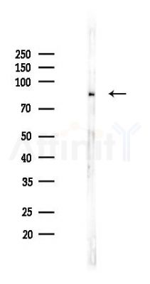 STAT1 Recombinant Rabbit mAb - Western blot analysis of lysates from HUVEC cells(LPS,4h treatment), using STAT1 Recombinant Rabbit mAb at 1/1000 dilution.