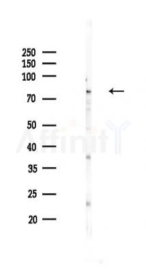 STAT1 Recombinant Rabbit mAb - Western blot analysis of lysates from Rat spleen, using STAT1 Recombinant Rabbit mAb at 1/1000 dilution.