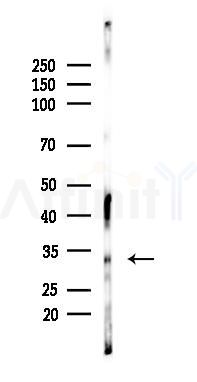 MyD88 Recombinant Rabbit mAb - Western blot analysis of lysates from Rat brain, using MyD88 Recombinant Rabbit mAb at 1/1000 dilution.