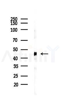 Parkin Recombinant Rabbit mAb - Western blot analysis of lysates from Mouse brain, using Parkin Recombinant Rabbit mAb at 1/1000 dilution.