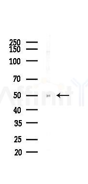 Parkin Recombinant Rabbit mAb - Western blot analysis of lysates from HepG2 cells(starvation,24h treatment), using Parkin Recombinant Rabbit mAb at 1/1000 dilution.