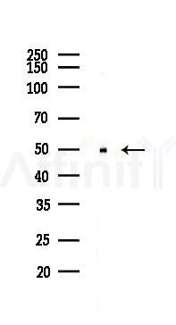 Parkin Recombinant Rabbit mAb - Western blot analysis of lysates from COLO205 cells(heat-shock,45min treatment), using Parkin Recombinant Rabbit mAb at 1/1000 dilution.