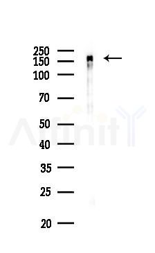 EGFR Recombinant Rabbit mAb - Western blot analysis of lysates from Hela cells(LPS 4h treatment), using EGFR Recombinant Rabbit mAb at 1/1000 dilution.