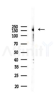 Phospho-EGFR (Tyr1068) Recombinant Rabbit mAb - Western blot analysis of lysates from PC12 cells(LPS 4h treatment), using Phospho-EGFR (Tyr1068) Recombinant Rabbit mAb at 1/1000 dilution.