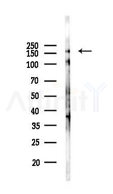 Phospho-EGFR (Tyr1068) Recombinant Rabbit mAb - Western blot analysis of lysates from Hela cells(UV 30min treatment), using Phospho-EGFR (Tyr1068) Recombinant Rabbit mAb at 1/1000 dilution.