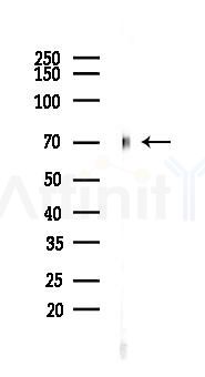 SOX9 Recombinant Rabbit mAb - Western blot analysis of lysates from HepG2 cells(starvation,24h treatment), using SOX9 Recombinant Rabbit mAb at 1/1000 dilution.