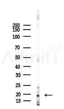 Phospho-Histone H2A.X (Ser139) Recombinant Rabbit mAb - Western blot analysis of lysates from Mouse brain, using Phospho-gamma H2A.