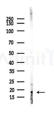 Phospho-Histone H2A.X (Ser139) Recombinant Rabbit mAb - Western blot analysis of lysates from HepG2 cells(starvation,24h treatment), using Phospho-gamma H2A.