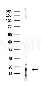 Phospho-Histone H2A.X (Ser139) Recombinant Rabbit mAb - Western blot analysis of lysates from COLO205 cells(heat-shock,45min treatment), using Phospho-gamma H2A.
