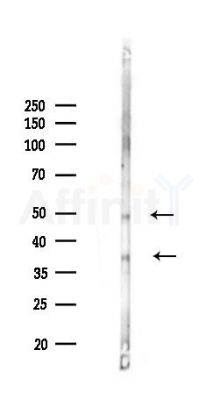 Caspase 9 Recombinant Rabbit mAb - Western blot analysis of lysates from Mouse liver, using Caspase-9 Recombinant Rabbit mAb at 1/1000 dilution.
