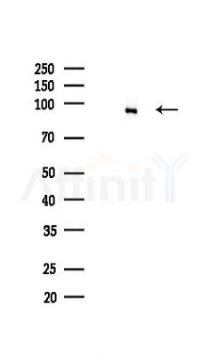 IKK alpha Recombinant Rabbit mAb - Western blot analysis of lysates from HUVEC cells(LPS,4h treatment), using IKK alpha Recombinant Rabbit mAb at 1/1000 dilution.