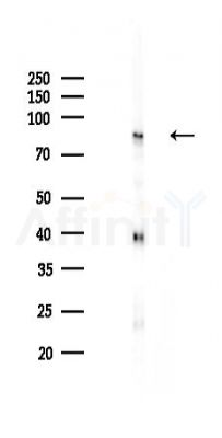IKK alpha Recombinant Rabbit mAb - Western blot analysis of lysates from Rat spleen, using IKK alpha Recombinant Rabbit mAb at 1/1000 dilution.