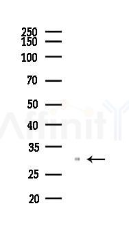 NQO1 Recombinant Rabbit mAb - Western blot analysis of lysates from COLO205 cells(heat-shock,45min treatment), using NQO1 Recombinant Rabbit mAb at 1/1000 dilution.