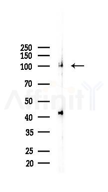 LGR5 Recombinant Rabbit mAb - Western blot analysis of lysates from Rat lung, using GPCR GPR49 Recombinant Rabbit mAb at 1/1000 dilution.