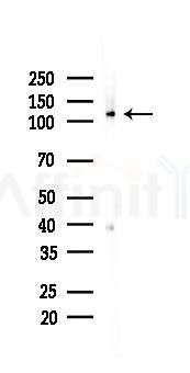 ULK1 Recombinant Rabbit mAb - Western blot analysis of lysates from A375 cells(heat-shock,45min treatment), using ULK1 Rabbit mAb at 1/1000 dilution.