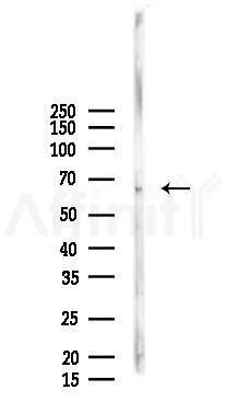 F4/80 Recombinant Rabbit mAb - Western blot analysis of lysates from Rat brain, using F4/80 Recombinant Rabbit mAb at 1/1000 dilution.