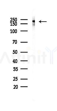Collagen IV Recombinant Rabbit mAb - Western blot analysis of lysates from HepG2 cells(starvation,24h treatment), using Collagen IV Recombinant Rabbit mAb at 1/1000 dilution.