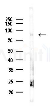 MDM2 Recombinant Rabbit mAb - Western blot analysis of lysates from COLO205 cells(heat-shock,45min treatment), using MDM2 Recombinant Rabbit mAb at 1/1000 dilution.