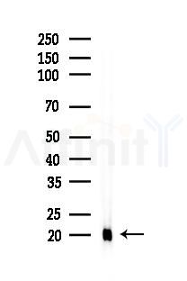4E-BP1 Recombinant Rabbit mAb - Western blot analysis of lysates from A375 cells(heat-shock,45min treatment), using 4E BP1 Rabbit mAb at 1/1000 dilution.