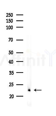 4E-BP1 Recombinant Rabbit mAb - Western blot analysis of lysates from Rat lung, using 4E BP1 Rabbit mAb at 1/1000 dilution.
