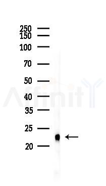 4E-BP1 Recombinant Rabbit mAb - Western blot analysis of lysates from HepG2 cells(heat-shock,45min treatment), using 4E BP1 Rabbit mAb at 1/1000 dilution.