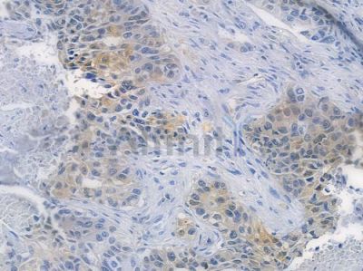 4E-BP1 Recombinant Rabbit mAb - BF3107 at 1/100 staining human normal placenta tissue by IHC-P.