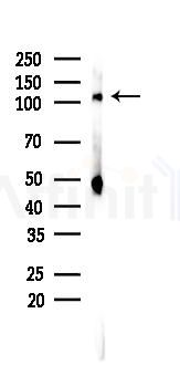 NF kappaB p105/p50 Recombinant Rabbit mAb - Western blot analysis of lysates from A375 cells(heat-shock,45min treatment), using NFkB p105/p50 Rabbit mAb at 1/1000 dilution.
