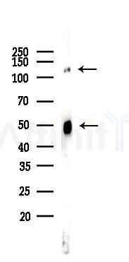 NF kappaB p105/p50 Recombinant Rabbit mAb - Western blot analysis of lysates from HepG2 cells(heat-shock,45min treatment), using NFkB p105/p50 Rabbit mAb at 1/1000 dilution.