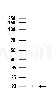 LC3A Recombinant Rabbit mAb - Western blot analysis of lysates from Rat heart, using LC3A Recombinant Rabbit mAb at 1/1000 dilution.
