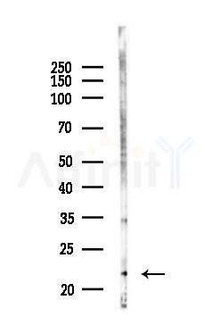IL10 Recombinant Rabbit mAb - Western blot analysis of lysates from Hela cells(LPS 4h treatment), using IL-10 Recombinant Rabbit mAb at 1/1000 dilution.