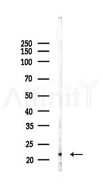 IL10 Recombinant Rabbit mAb - Western blot analysis of lysates from Rat lung, using IL-10 Recombinant Rabbit mAb at 1/1000 dilution.