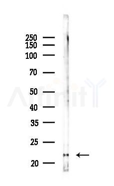 IL10 Recombinant Rabbit mAb - Western blot analysis of lysates from RAW264.