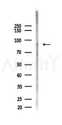 Phospho-beta Catenin (Thr41/Ser45) Recombinant Rabbit mAb - Western blot analysis of lysates from EC304 cells(starvation, 24h treatment), using Phospho-beta Catenin (Thr41/Ser45) Recombinant Rabbit mAb at 1/1000 dilution.