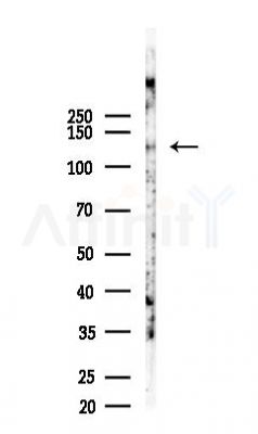 JAK1 Recombinant Rabbit mAb - Western blot analysis of lysates from EC304 cells(starvation, 24h treatment), using JAK1 Recombinant Rabbit mAb at 1/1000 dilution.