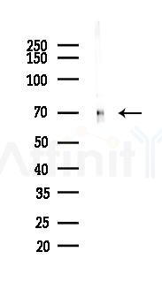 Keap1 Recombinant Rabbit mAb - Western blot analysis of lysates from HepG2 cells(starvation,24h treatment), using Keap1 Recombinant Rabbit mAb at 1/1000 dilution.