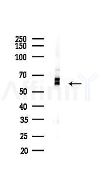 Keap1 Recombinant Rabbit mAb - Western blot analysis of lysates from COLO205 cells(heat-shock,45min treatment), using Keap1 Recombinant Rabbit mAb at 1/1000 dilution.