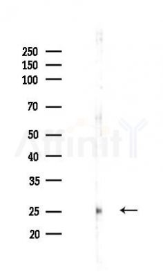 BDNF Recombinant Rabbit mAb - Western blot analysis of lysates from HUVEC cells(LPS,4h treatment), using BDNF Recombinant Rabbit mAb at 1/1000 dilution.