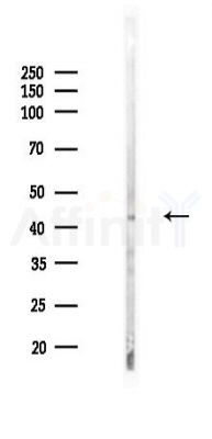 GFAP Recombinant Rabbit mAb - Western blot analysis of lysates from Rat spleen, using GFAP Recombinant Rabbit mAb at 1/1000 dilution.