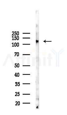 Phospho-FAK (Tyr397) Recombinant Rabbit mAb - Western blot analysis of lysates from Hela cells(LPS, 4h treatment), using Phospho-FAK (Tyr397) Recombinant Rabbit mAb at 1/1000 dilution.