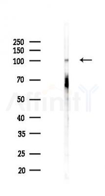 FAK Recombinant Rabbit mAb - Western blot analysis of lysates from HepG2 cells(starvation,24h treatment), using FAK Recombinant Rabbit mAb at 1/1000 dilution.